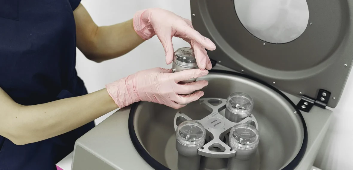 IVF behandeling bij MC Kinderwens